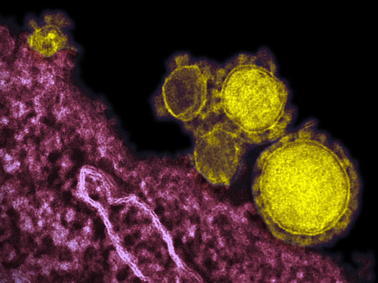 Supply chains face Omicron challenge both in UK and globally…